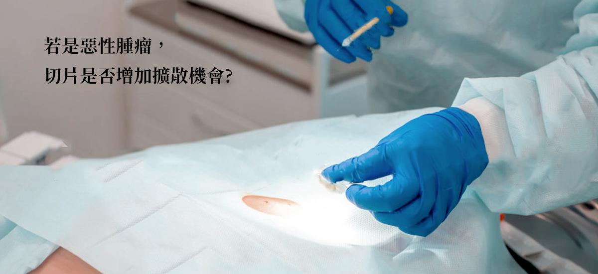 【衛教馨知】 萬一是惡性腫瘤，切片會不會增加擴散的機會？