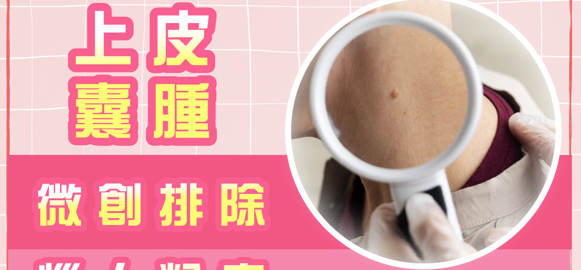 微創排除上皮囊腫無難事