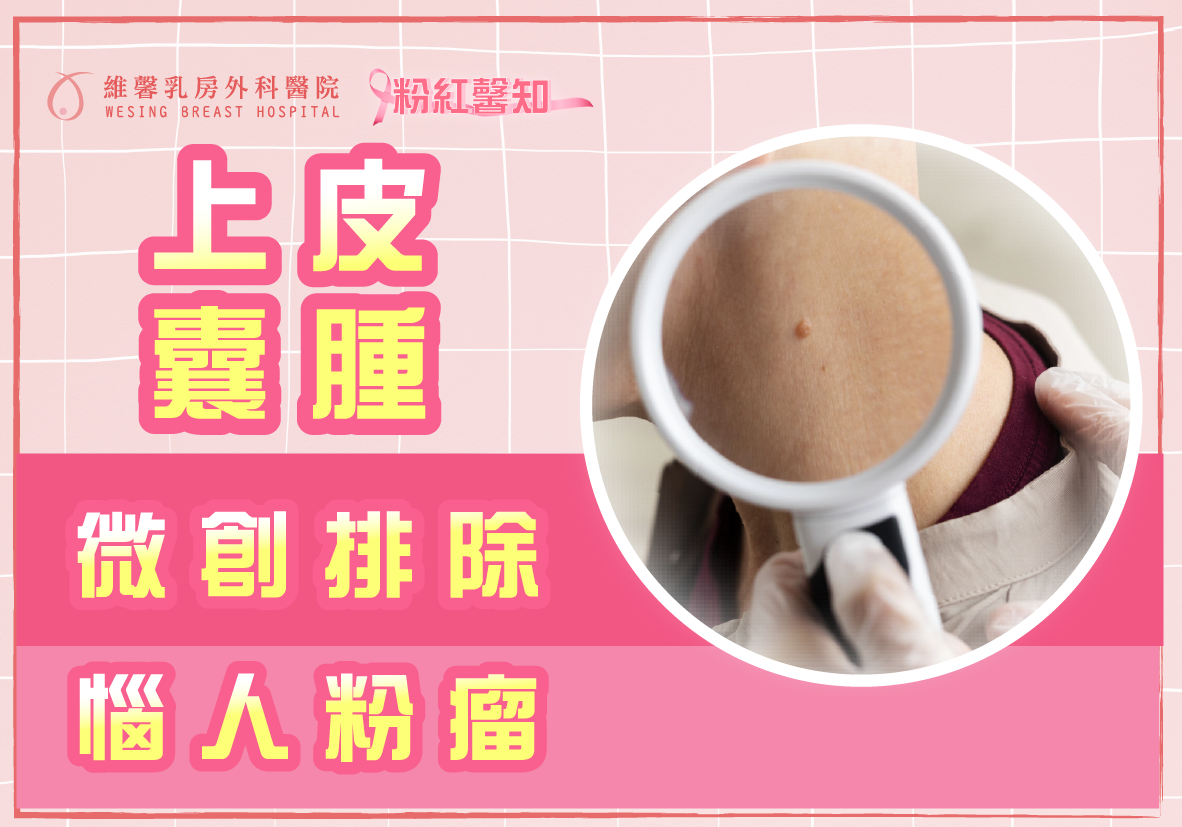 微創排除上皮囊腫無難事 3 微創排除上皮囊腫無難事